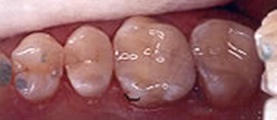 Dental Office in Woodmere
