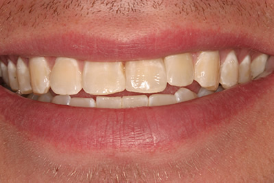 Woodmere Implants Dentistry