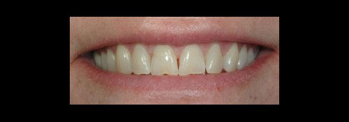 Cosmetic Dentist in Woodmere