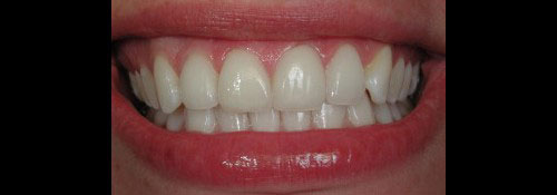 Cosmetic Dentist Office in Woodmere