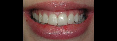 Cosmetic Dentist in Woodmere