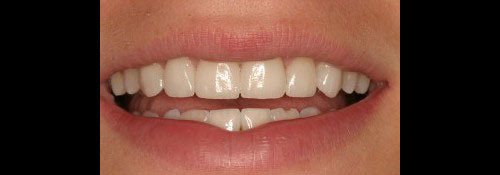 Cosmetic Dentist Office in Woodmere