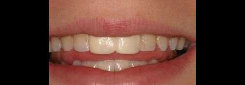 Cosmetic Dentist Office in Woodmere