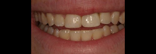 Dental Office in Woodmere