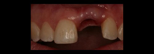 Cosmetic Dentist in Woodmere