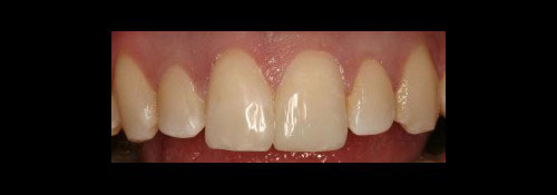 Woodmere Cosmetic Dentistry