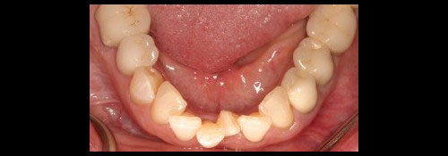 Top Dentist in Woodmere