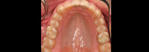 Cosmetic Dentist in Woodmere