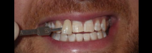 Woodmere Cosmetic Dentist